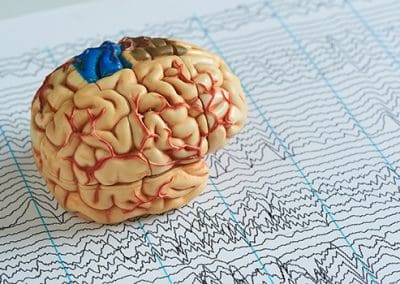 The Connection Between Strokes and Vascular Dementia